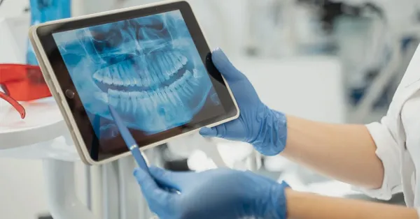 Explaining Each Part of Your Wisdom Tooth Surgery Bill